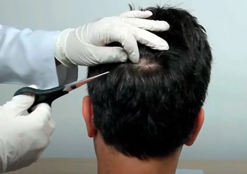 Universidades públicas estaduais podem exigir exame toxicológico para matrícula a partir de 2026