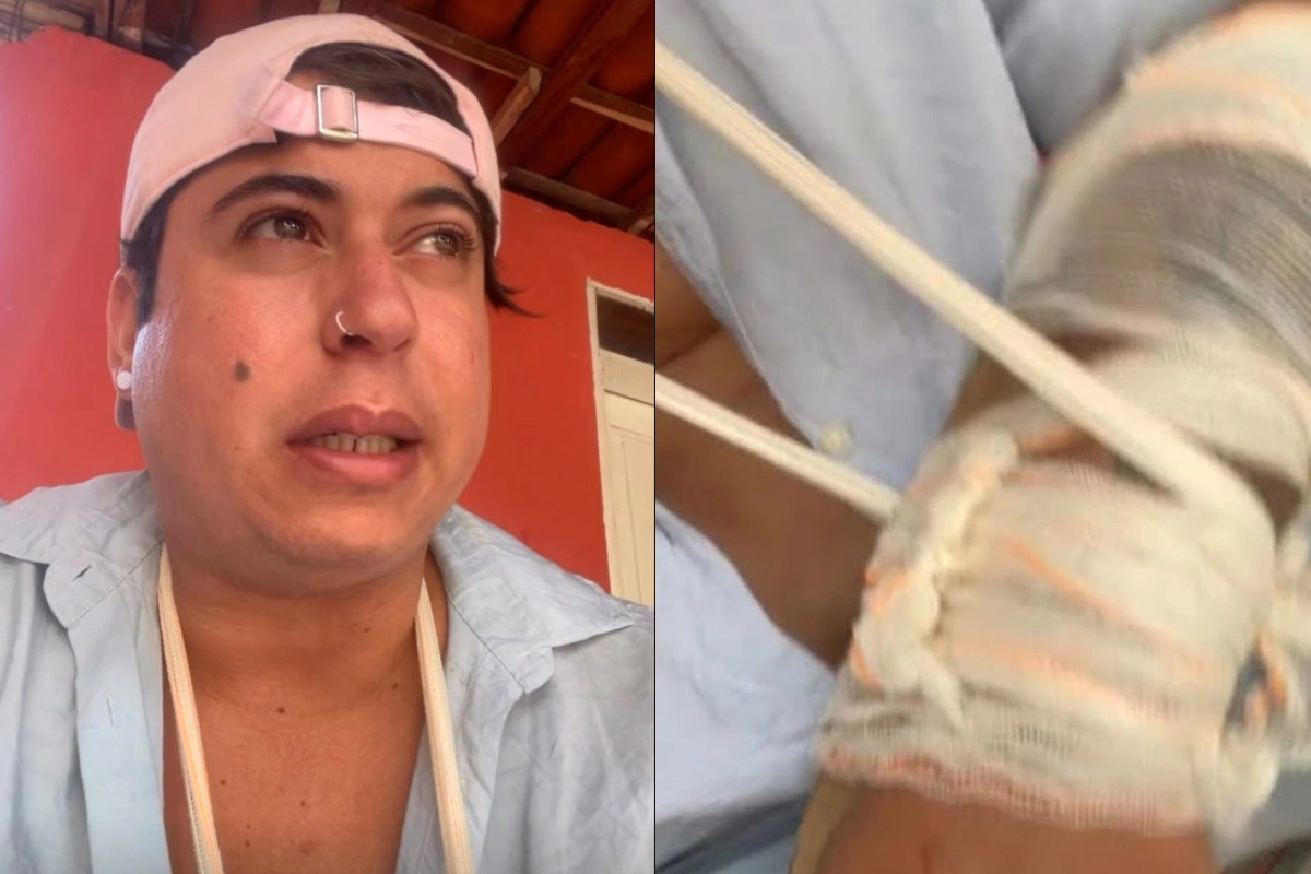 Cantor denuncia agressão e braço quebrado após confusão com segurança em show de Tayrone