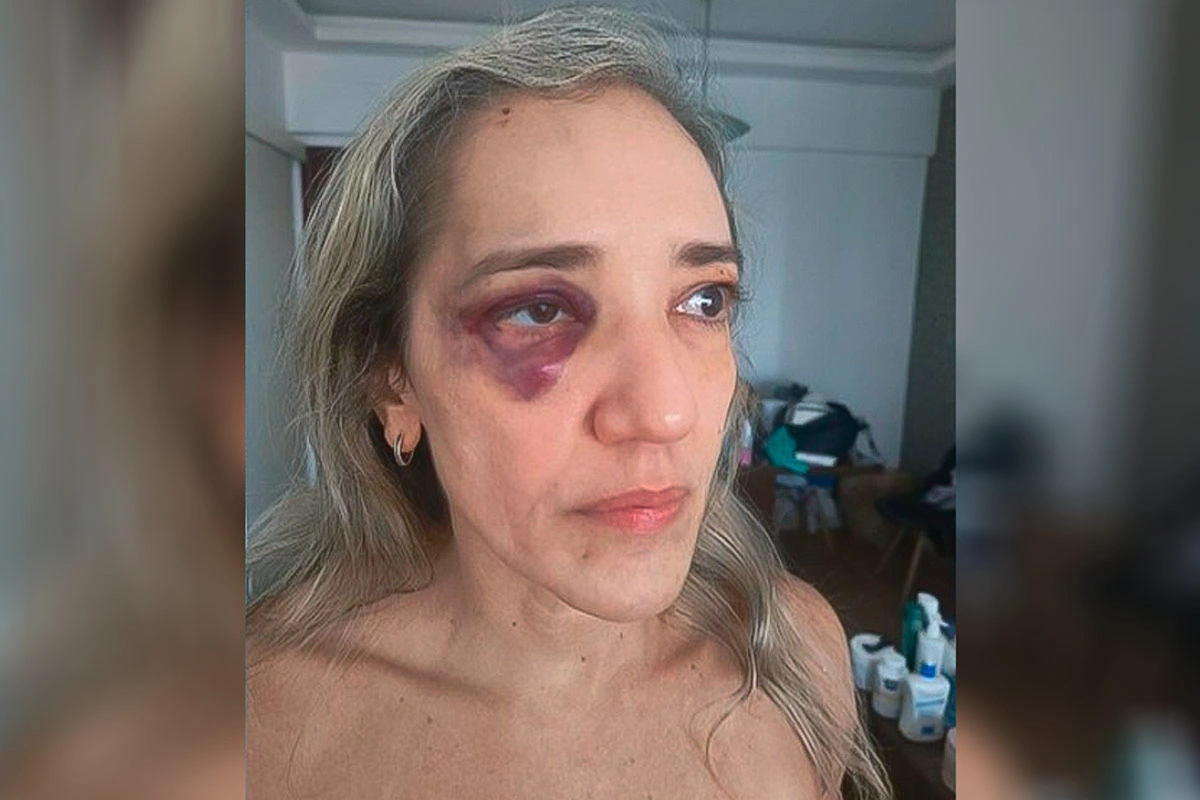Passageira é agredida por motorista de aplicativo após desistir da corrida por causa de capacete