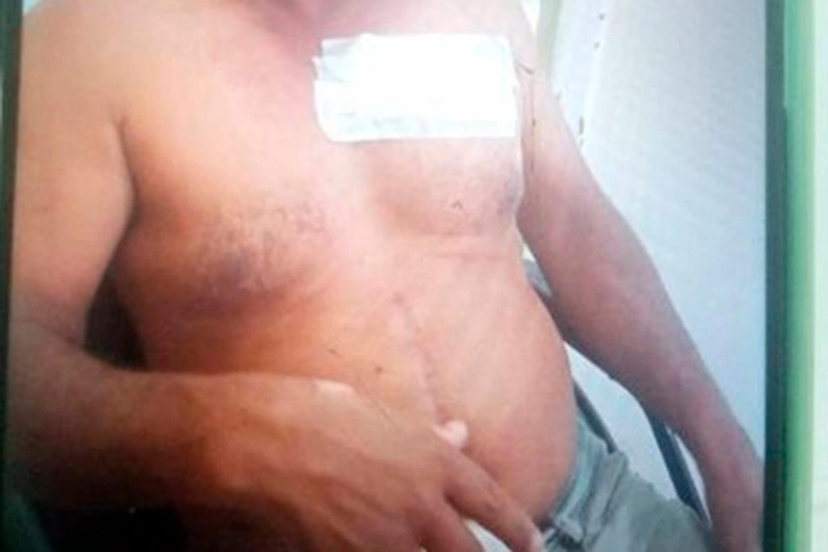 Homem é esfaqueado no tórax em Palmas de Monte Alto