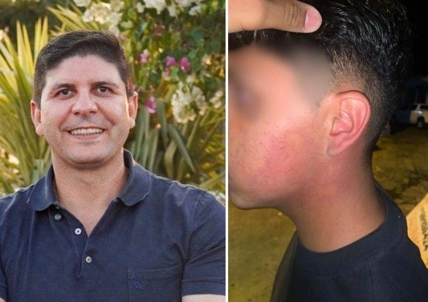 Jovem denuncia prefeito de Rio do Pires por agressão após mal-entendido em festa