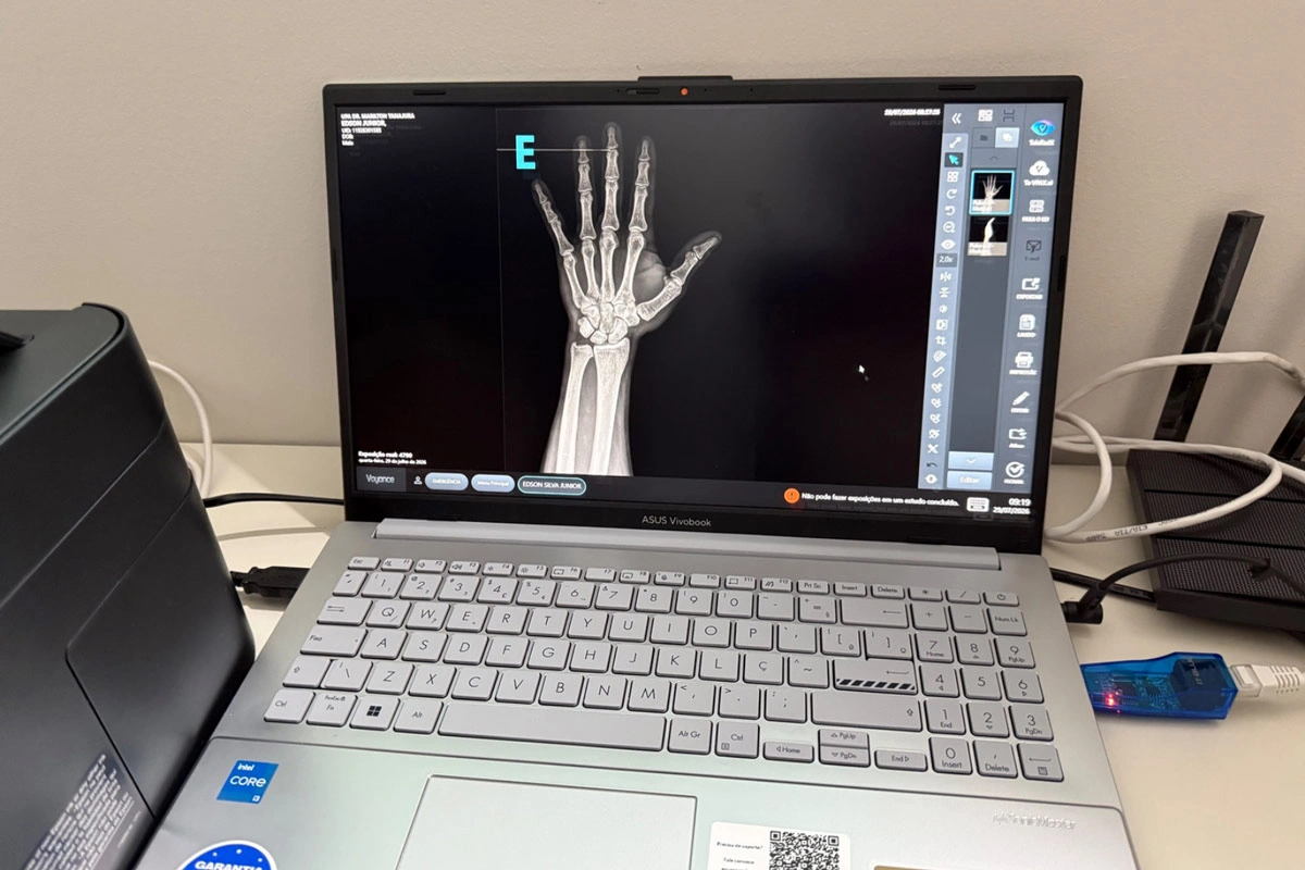 UPA de Livramento de Nossa Senhora recebe primeiro aparelho de Raio-X Digital da região