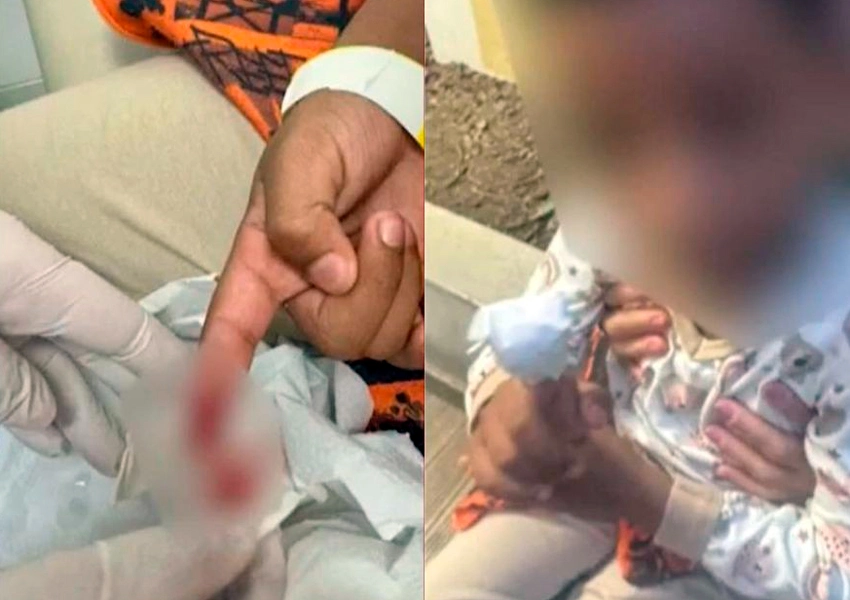 Menino de 6 anos é atacado por piranhas no lago da Barragem das Pedras de Jequié